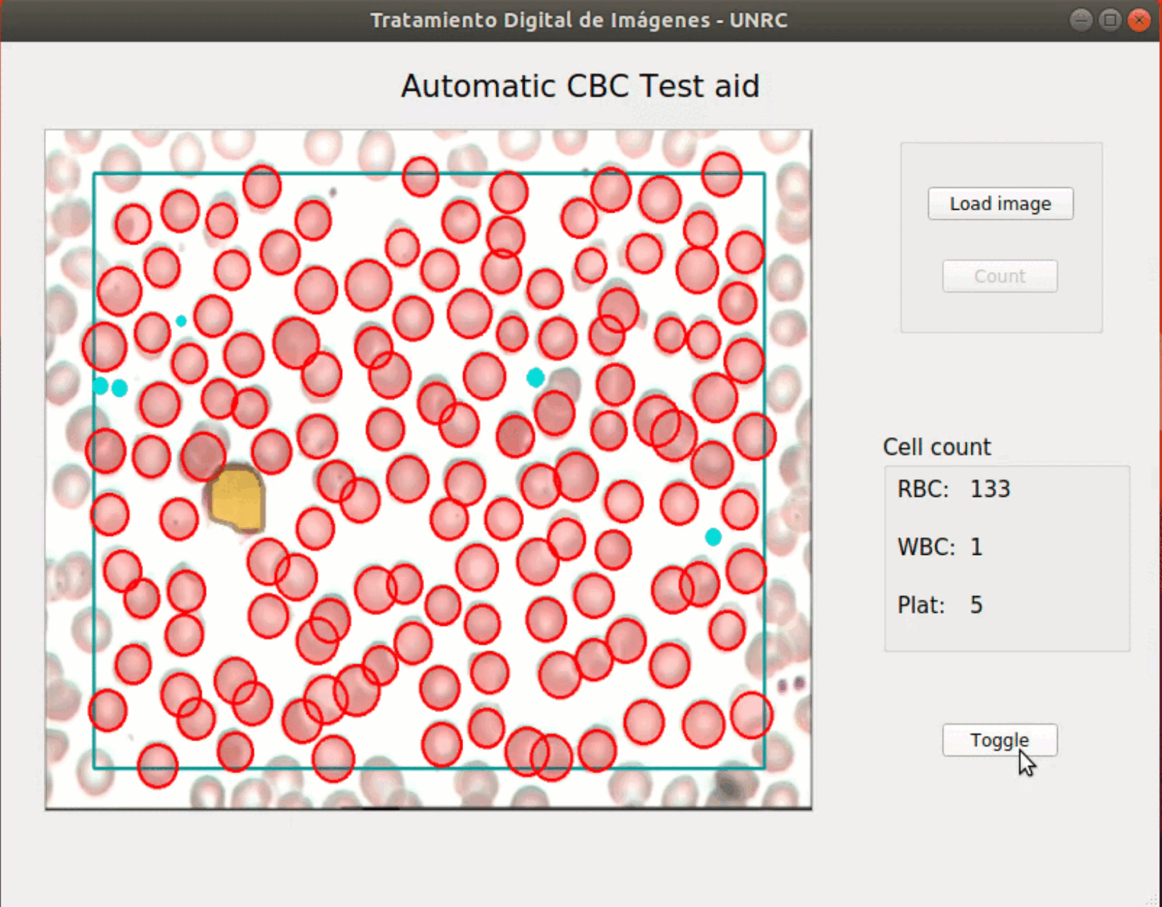 Blood Cells Count Aid — automated cell counting demo